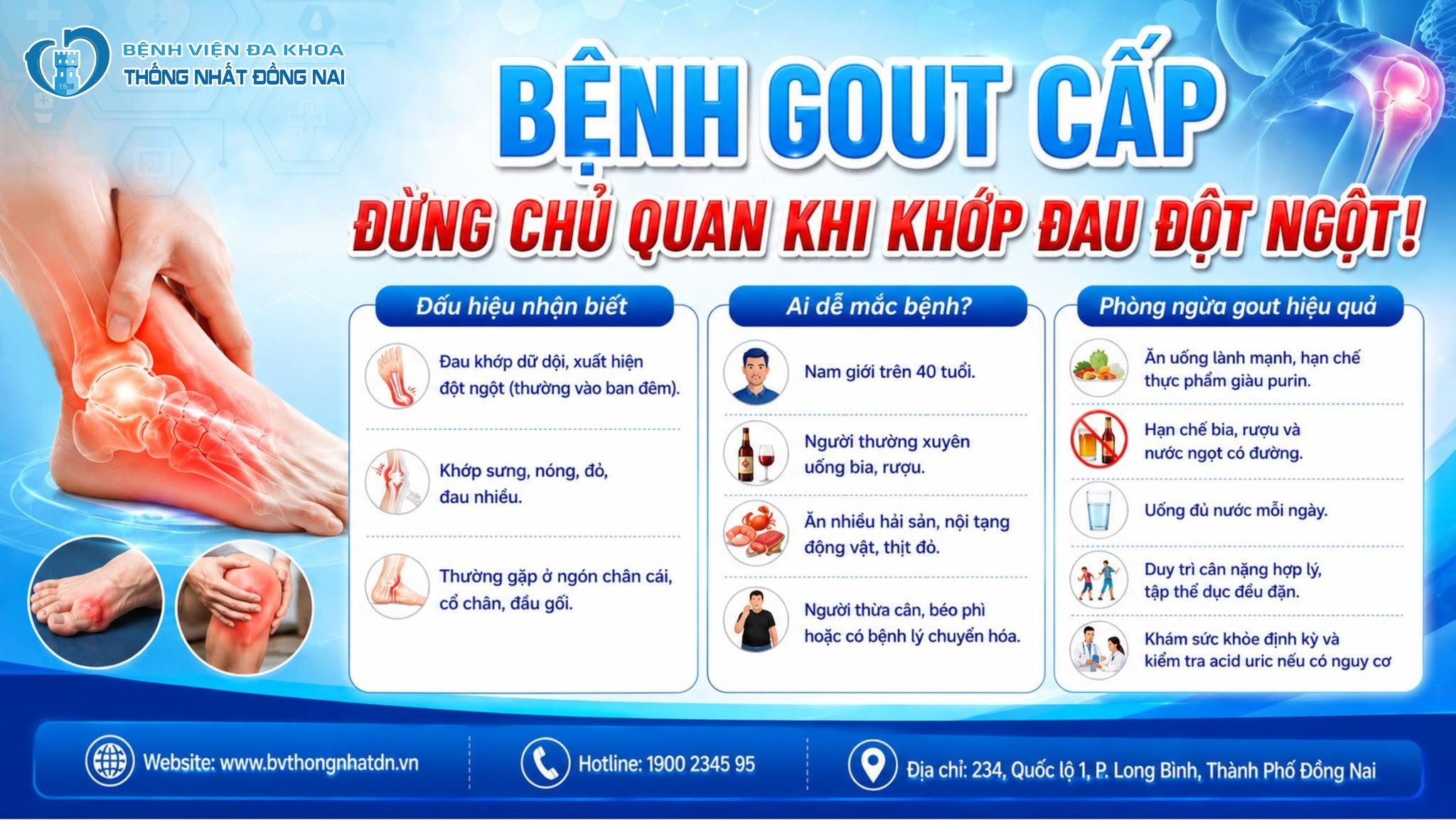 BỆNH GOUT CẤP – ĐỪNG CHỦ QUAN KHI KHỚP ĐAU ĐỘT NGỘT!