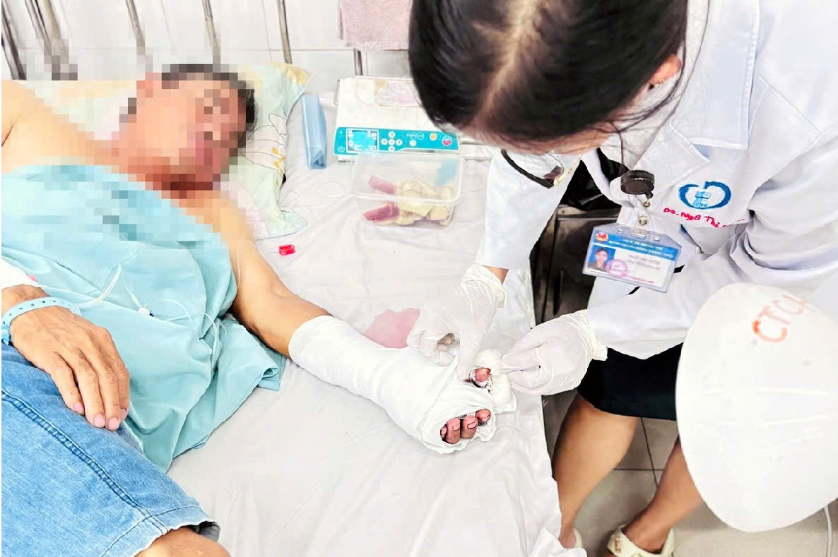 BVTN | NỐI THÀNH CÔNG HAI NGÓN TAY ĐỨT LÌA TRONG HƠN 10 GIỜ PHẪU THUẬT